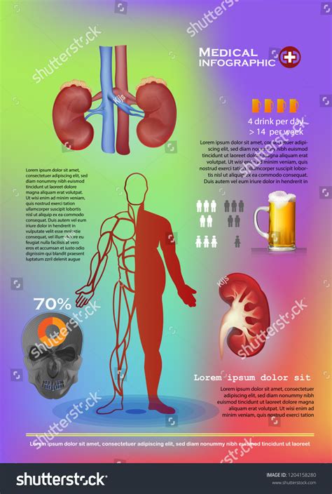 Alcohol Damage Kidney Stock Vector (Royalty Free) 1204158280 | Shutterstock