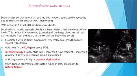 aortic valve disease.pptx