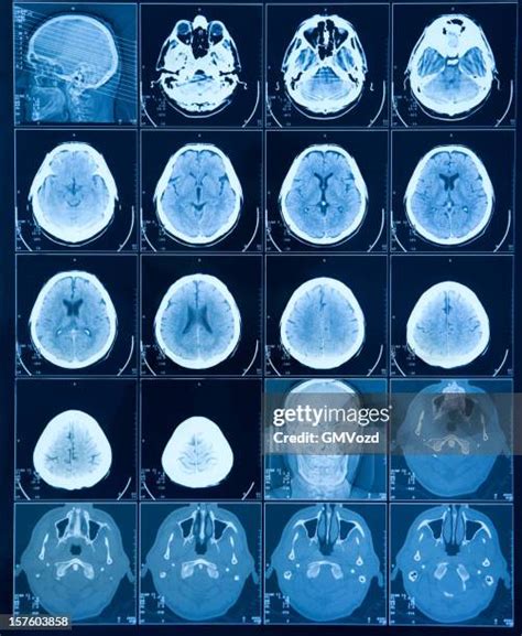 High Res Brain Scan Image 的图像结果