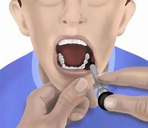 Image result for buccal