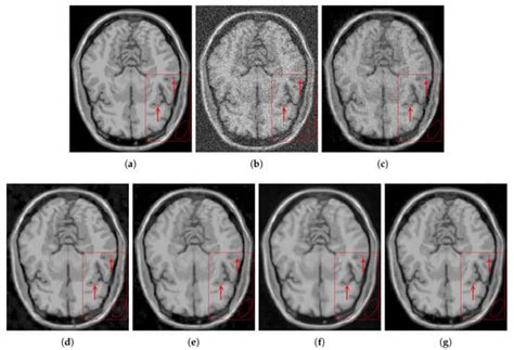Non-Local SVD Denoising of MRI Based on Sparse Representations