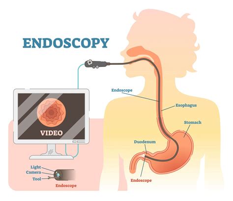 Endoscopy Services | Dr Ong Paediatrician & Gastroenterologist