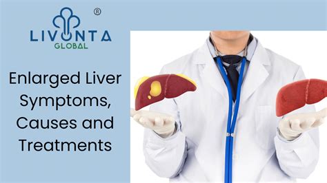 Enlarged Liver – Symptoms, Causes and Treatments - Livonta Global Pvt Ltd