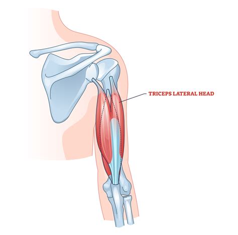 6 Best Lateral Head Triceps Exercises (with Pictures!) - Inspire US