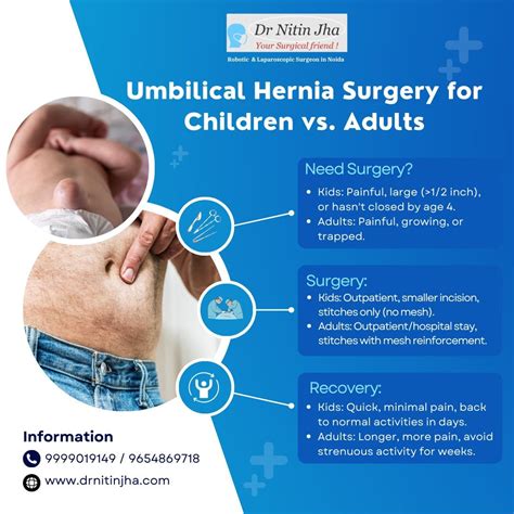 Umbilical hernia surgery for children and adults | Robotic and Laparoscopic hernia and gallstone ...