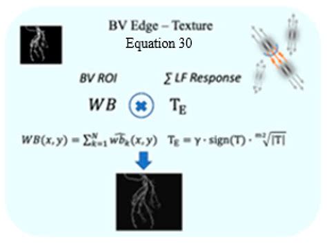 Visual System Inspired Algorithm for Enhanced Visibility in Coronary ...