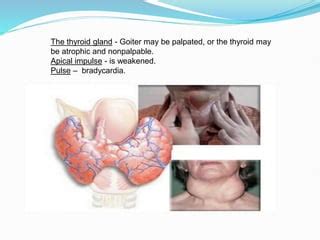 Image result for Thyroid Function Algorithm