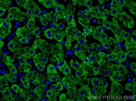 Complement factor B antibody (66154-1-Ig) | Proteintech