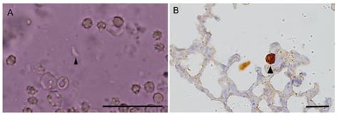 Isolation and Genetic Characterization of Toxoplasma gondii from a ...