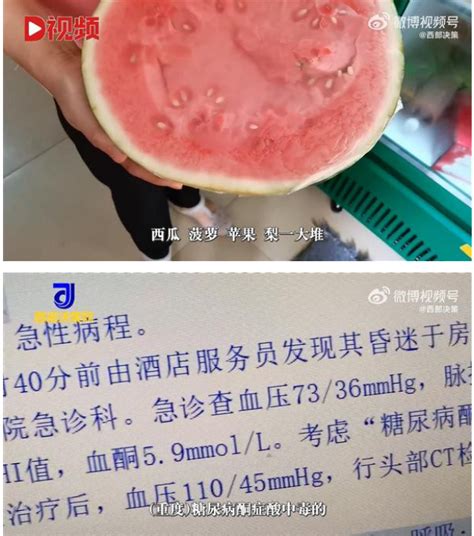 一口气吃半个西瓜，26岁小伙差点丧命-中国瞭望-万维读者网（电脑版）