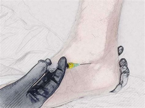 Image result for Ankle Injection Procedure
