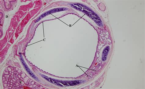 Esophagus Versus Trachea
