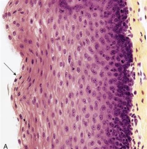 Image result for Ephilehal Tissue Sample