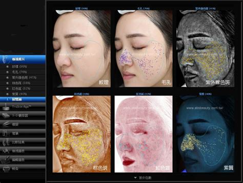 reveal皮肤检测分析仪 美国Reveal皮肤检测仪-美容资讯-美容资讯-广州美丽加美容设备有限公司