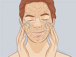 Image result for Exfoliate