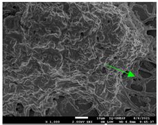 Influence of Zinc on Histoplasma capsulatum Planktonic and Biofilm Cells
