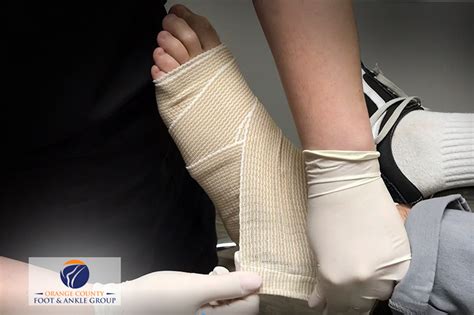Ankle Sprain | OC Feet