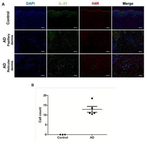 Production of IL-31 in CD45RO+CLA+H4R+ T Cells in Atopic Dermatitis