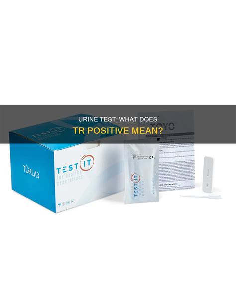 Urine Test: What Does Tr Positive Mean? | MedShun