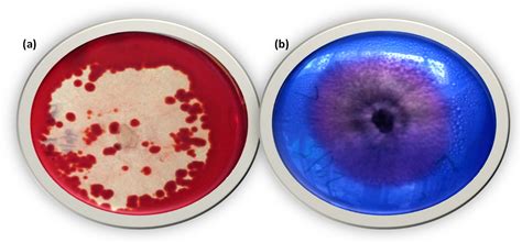 Live Biomass of Rigidoporus vinctus: A Sustainable Method for ...