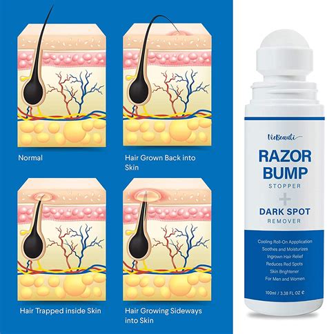 Buy EnaSkin Razor Bump Stopper Skin Care Solution for Men and Women ...