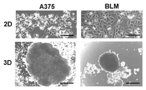 Differentiation States of Phenotypic Transition of Melanoma Cells Are ...