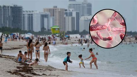 Confirmed: alert following outbreak of flesh-eating bacteria causing ...