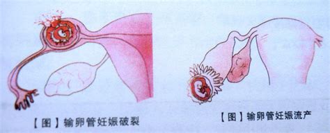 胎儿发育标准对照表图最新（孕期怎么看懂胎儿大小，双顶径，股骨长，头围和腹围？(附对照表)） | 说明书网