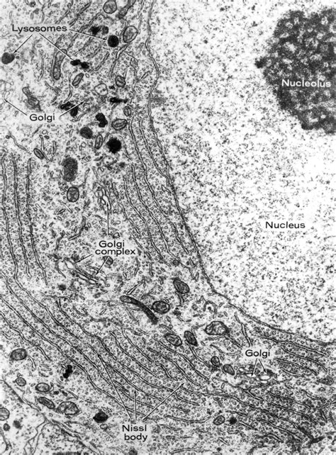 Ribosomes Microscope