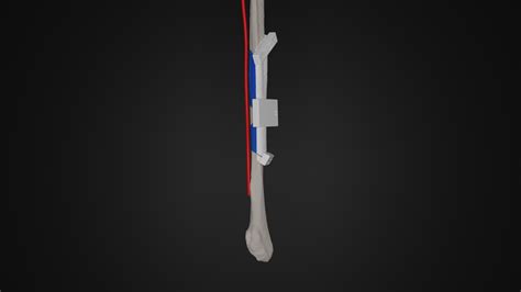 Patiëntenzorg Archives - 3D-Lab+