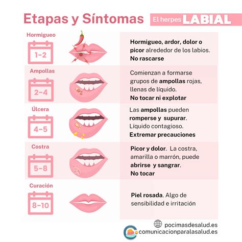 Todo lo que debes saber sobre los diferentes tipos de herpes labial ...