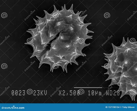 Daisy Pollen Under Electron Microscope Stock Photo - Image of dust ...