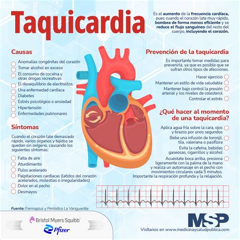 Taquicardia - Infografía