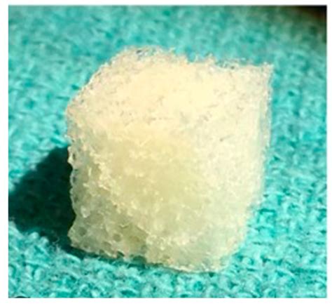 Image result for Flex Bone Matrix