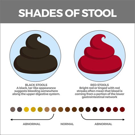 What to Do If You See Blood in the Toilet: Expert Advice