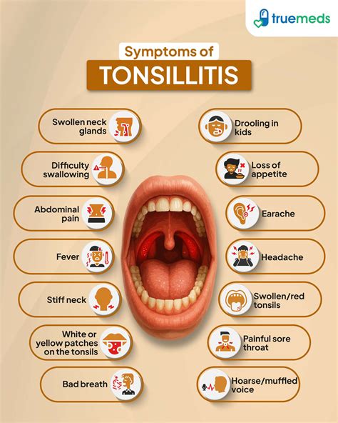 Tonsillitis: Causes, Symptoms & Treatment Options