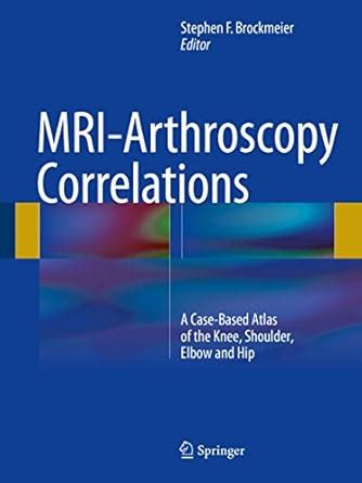 MRI-Arthroscopy Correlations: A Case-Based Atlas of the Knee, Shoulder ...
