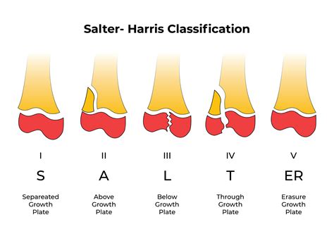 Wrist Examination & Pathology Module - Don't Forget the Bubbles