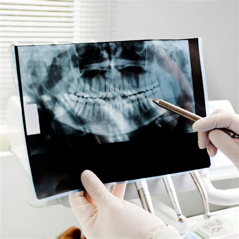 Image result for Tooth Extraction HD Images