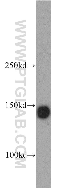 Integrin Alpha 3 antibody (21992-1-AP) | Proteintech