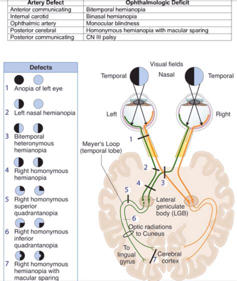 Quadrantenanopsie Therapie Therapie Bei Gesichtsfeldausfall Savir