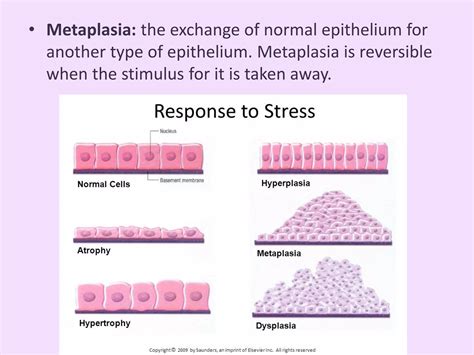 Metaplasia & Dysplasia | PPTX