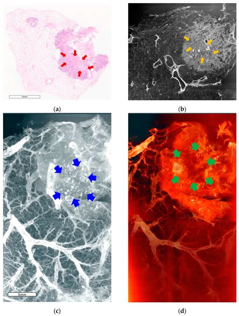 Synchrotron Radiation Refraction-Contrast Computed Tomography Based on ...