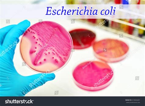 572 imágenes de Escherichia coli en agar sangre - Imágenes, fotos y ...