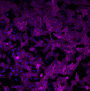 Janelia Fluor® HaloTag® Ligands | Janelia Fluor Dyes | Cell Imaging