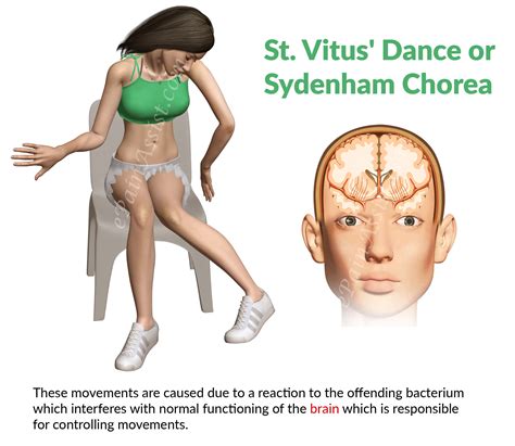 St. Vitus' Dance or Sydenham Chorea