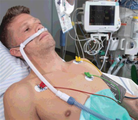 Image result for Awake Intubation