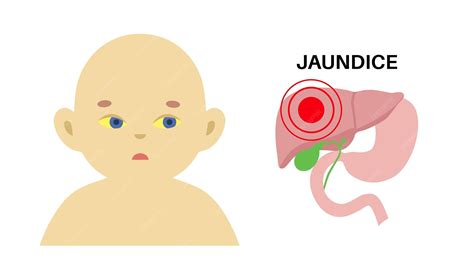 Jaundice yellow skin | Premium Vector