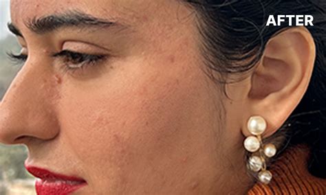 Invisible Primer Sunscreen for Open Pores, SPF 50 & PA+++ | Sunscoop ...