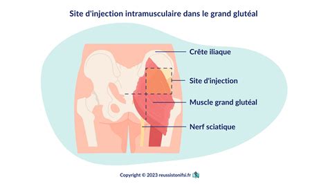 Guide pratique des injections intramusculaires - Réussis ton IFSI